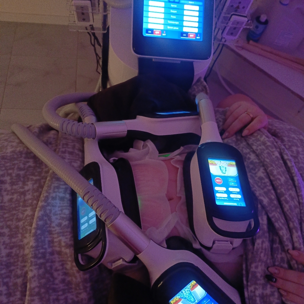 Абонемент на 40 манипул криолиполиза