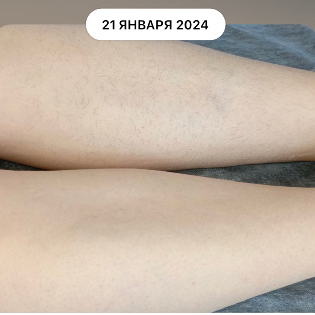 Голени