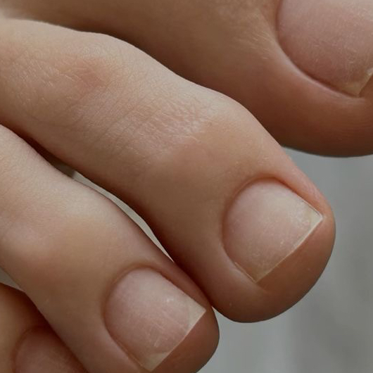 Педикюр без покрытия только пальчики (без обработки стоп)