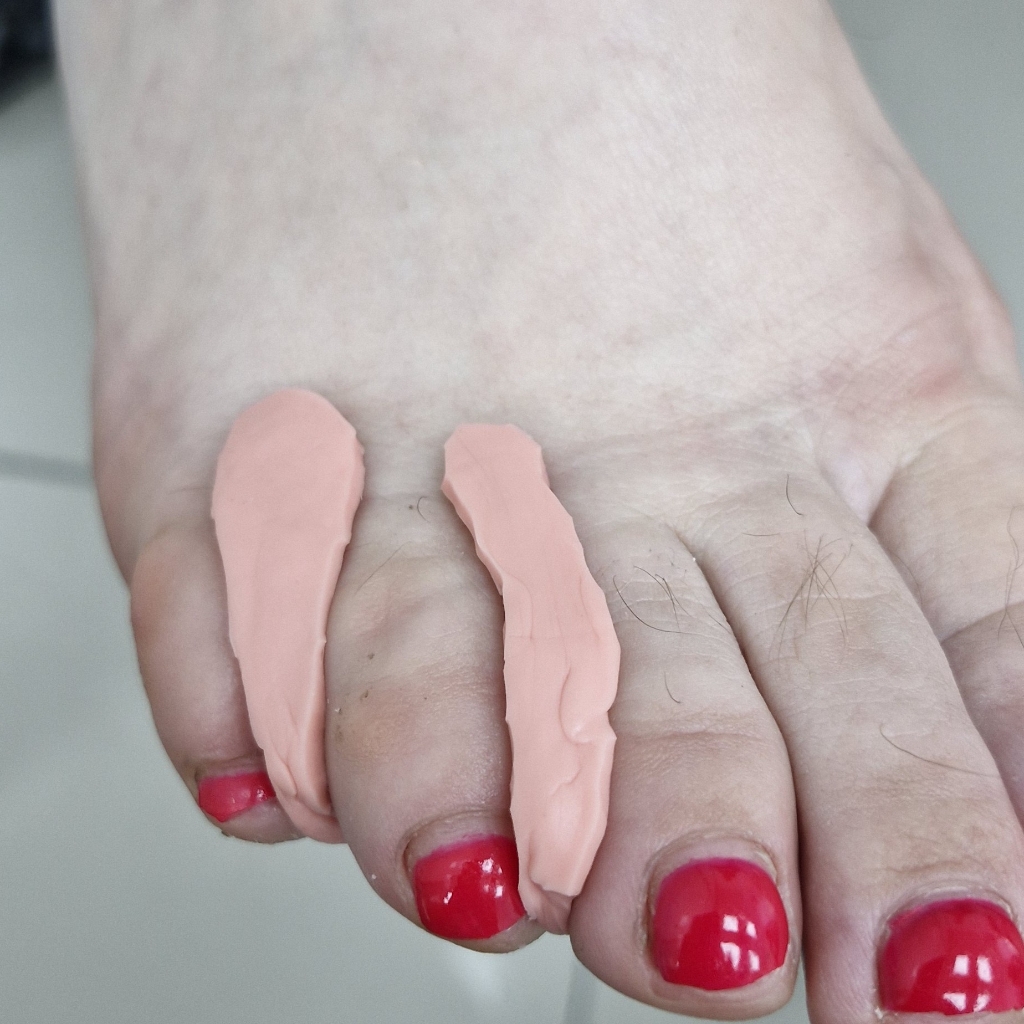 Индивидуальный ортоз