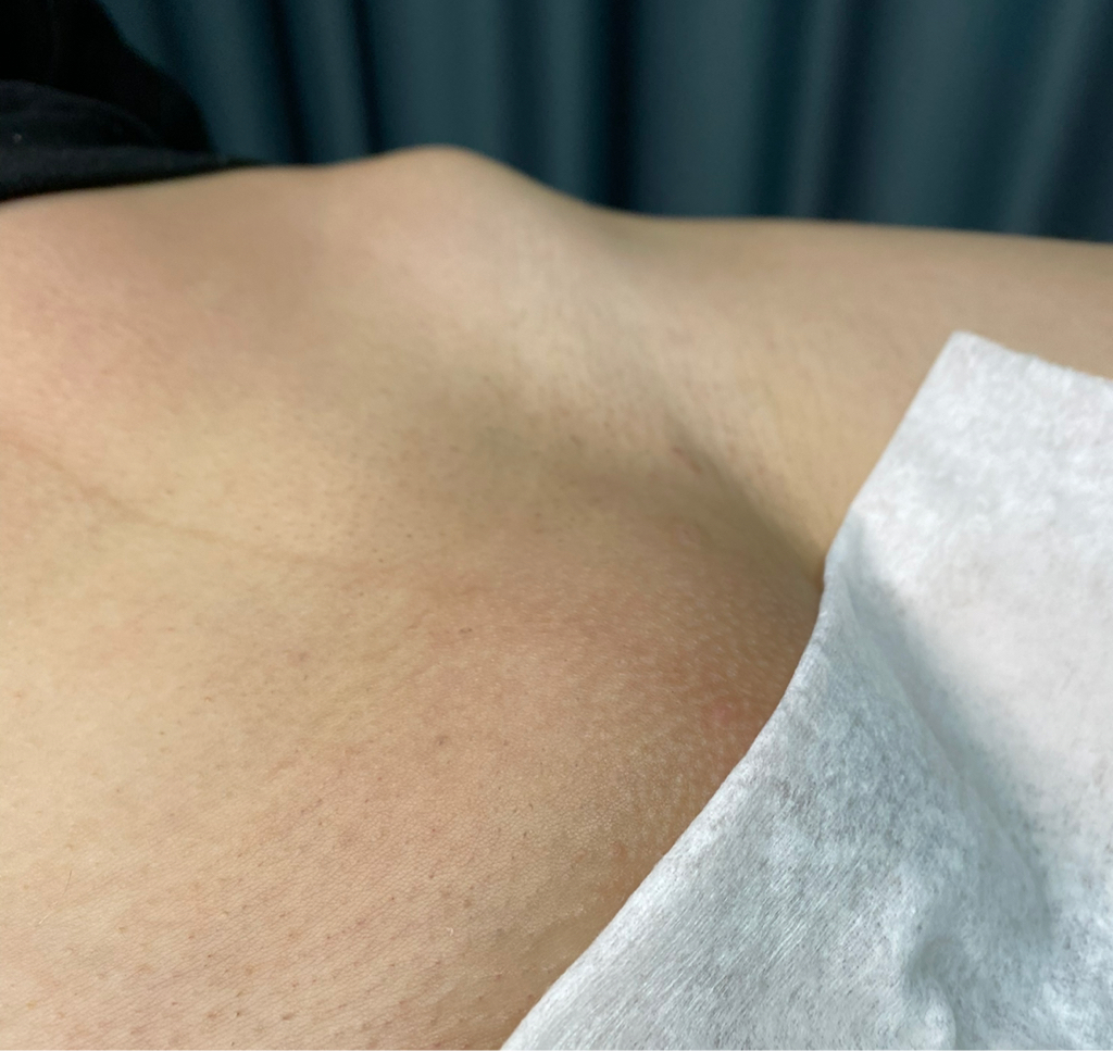 Глубокое бикини