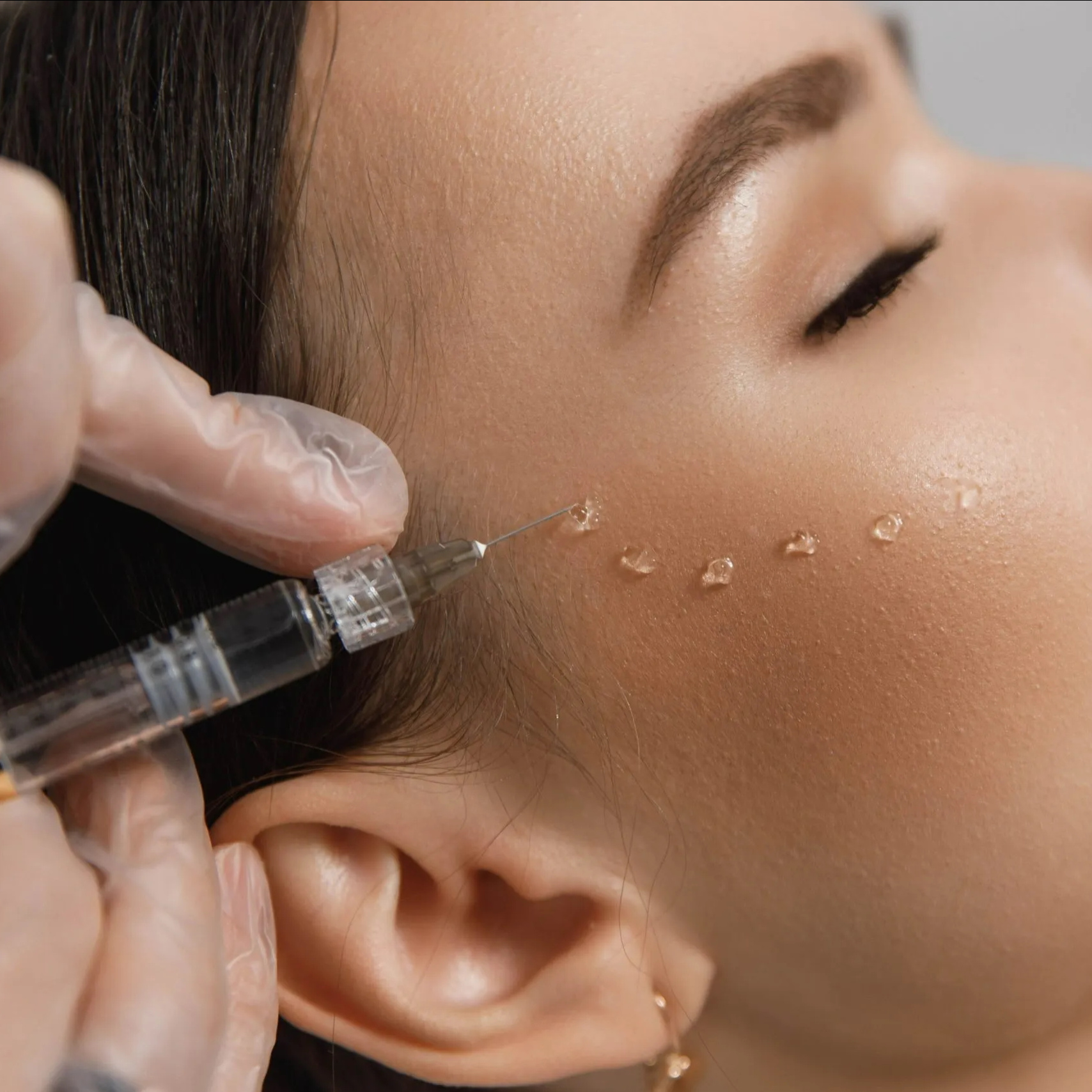 Мезотерапия, биоревитализация, биорепарация