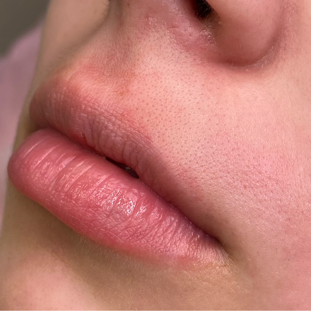 Усики/зона на лице