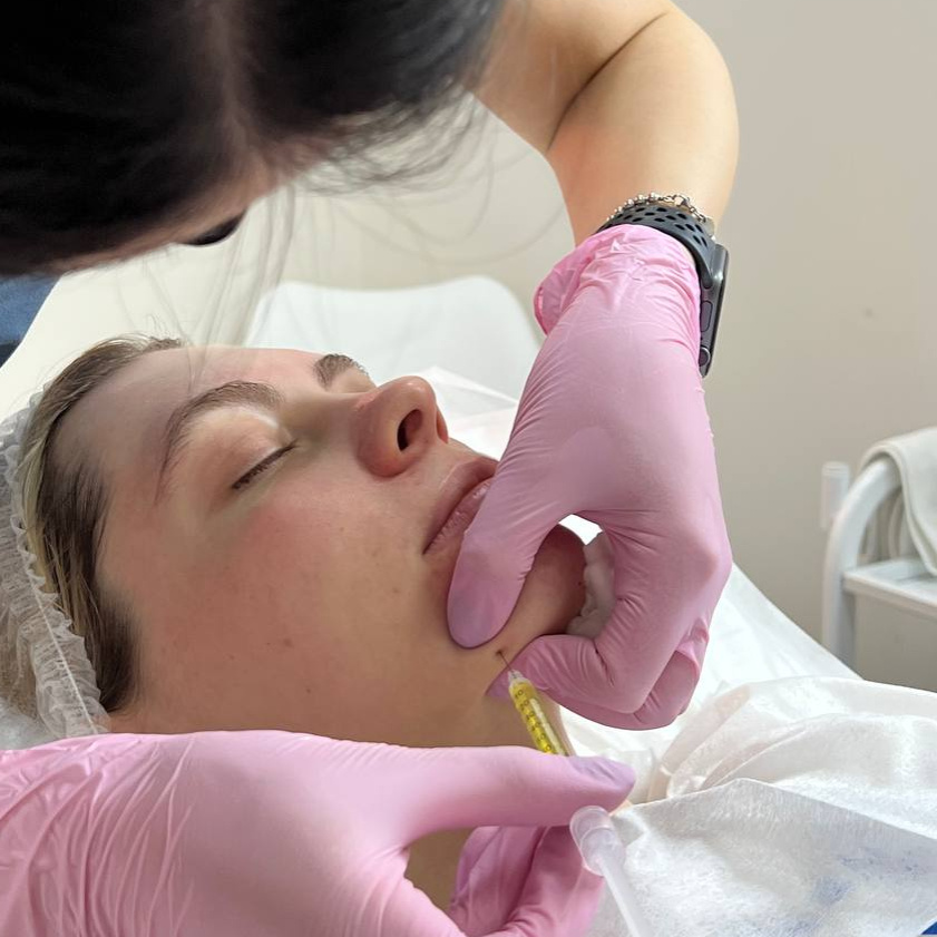 Контурная пластика лицо (скулы, подбородок и т.д.)