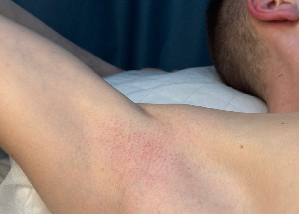 Мужские подмышечные впадины