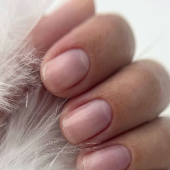 Протезирование травмированных и деформированных ногтей