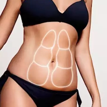 Криолиполиз