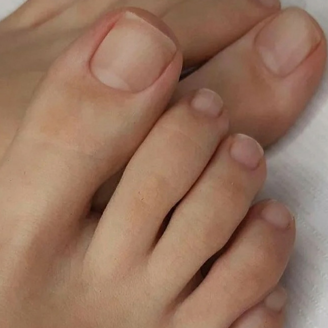 ПЕДИКЮР ГИГИЕНИЧЕСКИЙ