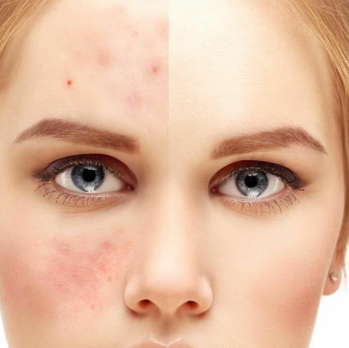 ДЕТОКС  (УЗ чистка, дарсонваль, ЭУ)