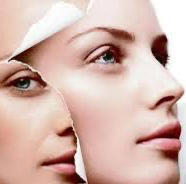 КОЛЛАГЕНОВОЕ ВОССТАНОВЛЕНИЕ ( RF лифтинг, Микротоки, Альгинат)