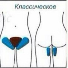 Классическое бикини