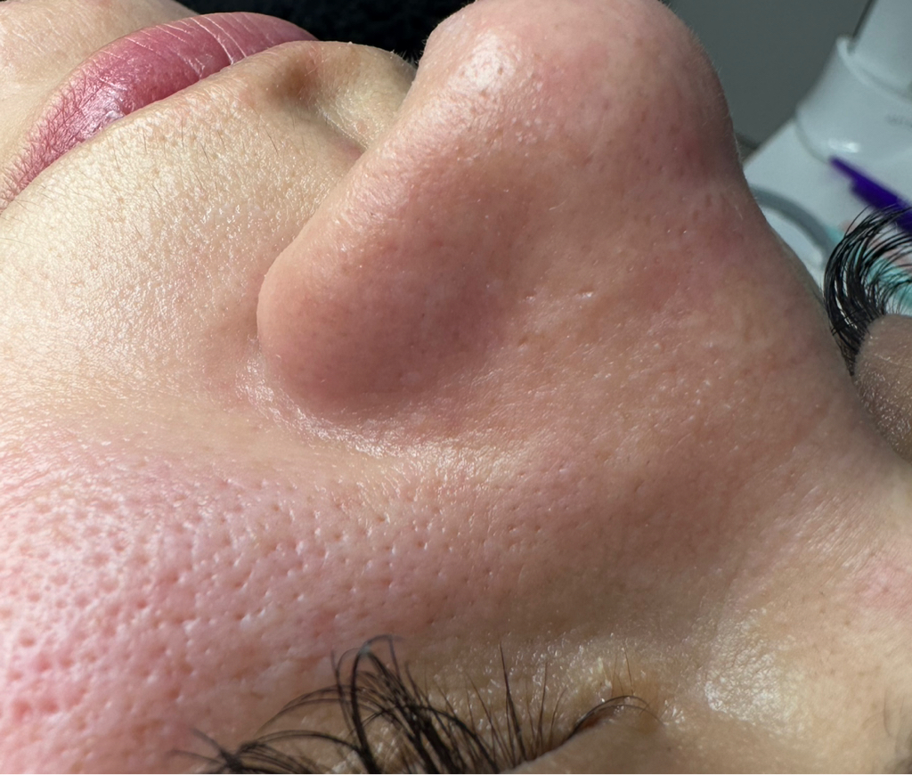 Чистка лица+фонофорез+альгинатная маска