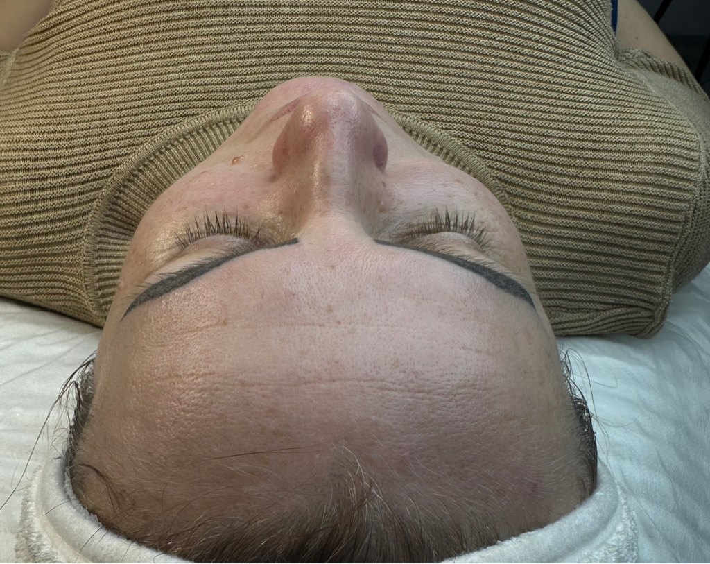 Ультрозвуковая чистка лица+альгинатная маска