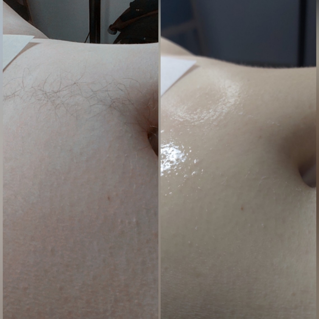 Живот/Поясница/Ягодицы