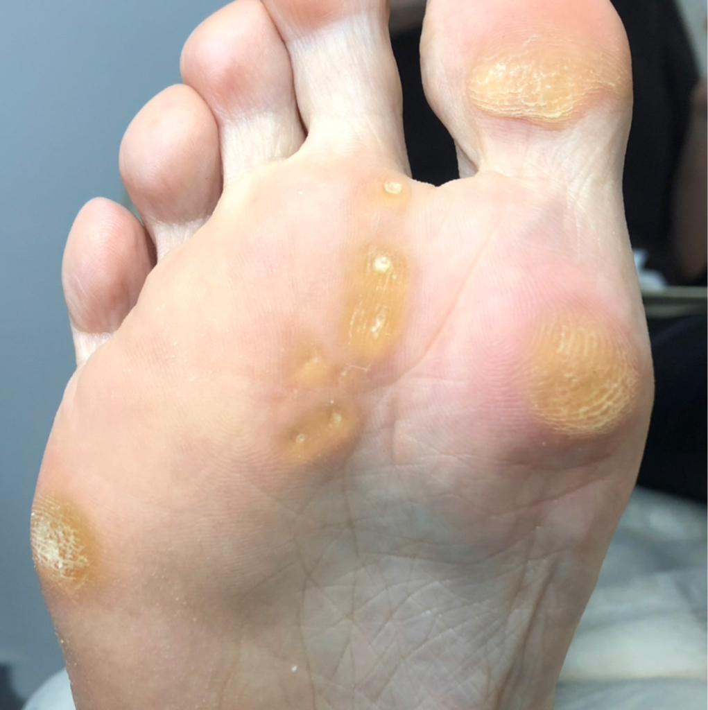 Педикюр сложная СТОПА+ПОКРЫТИЕ гель-лак