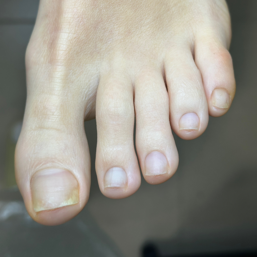 Обработка пальцев (покрытие лак снятие )