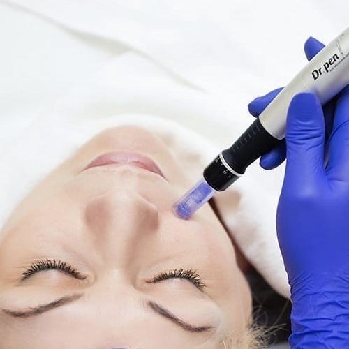 Фракционная мезотерапия