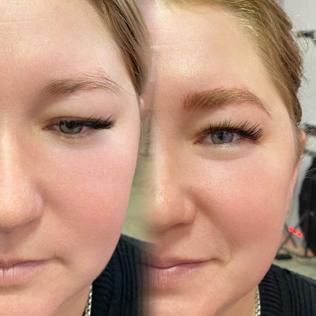 Аппаратные волоски