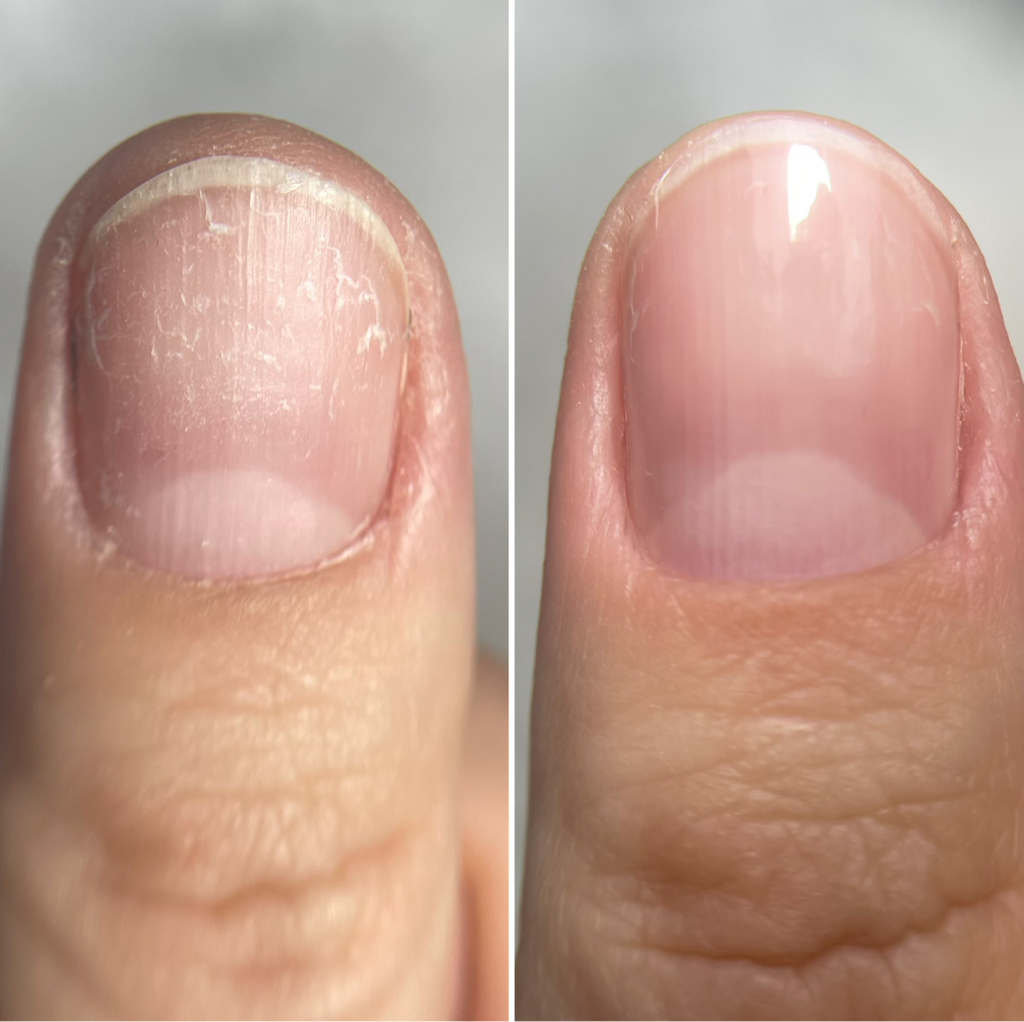 Восстановление ногтей Multiplazma