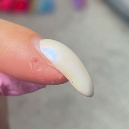 Архитектура ногтей (поднятие клюющих ногтей)/Nagelarchitektur