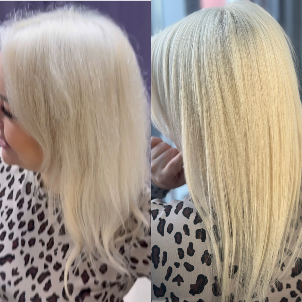 periche profesional Биксипластия