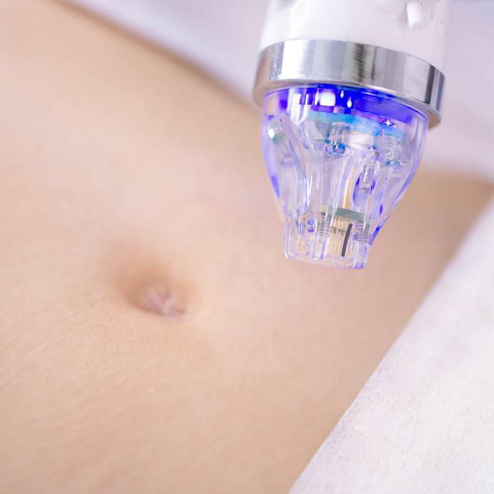 Живот (МИ-РФ)