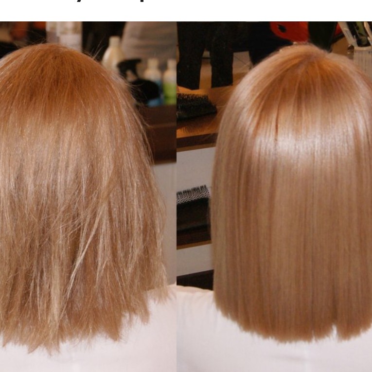 Холодный ботокс от 15-30 см