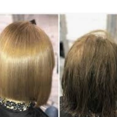 Холодный ботокс до 15 см