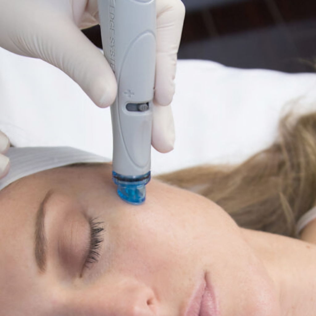 HydraFacial (ХайдраФешл)