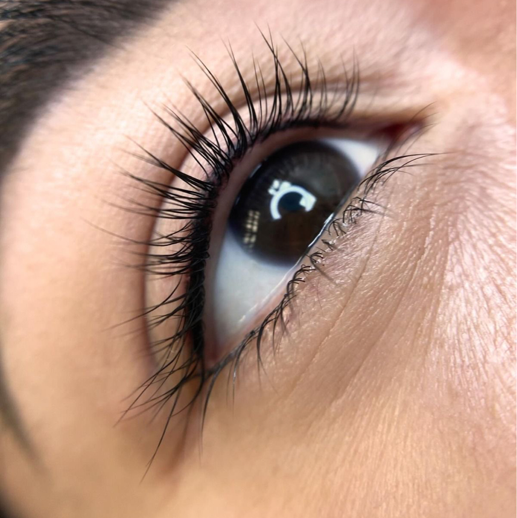 Межресничка