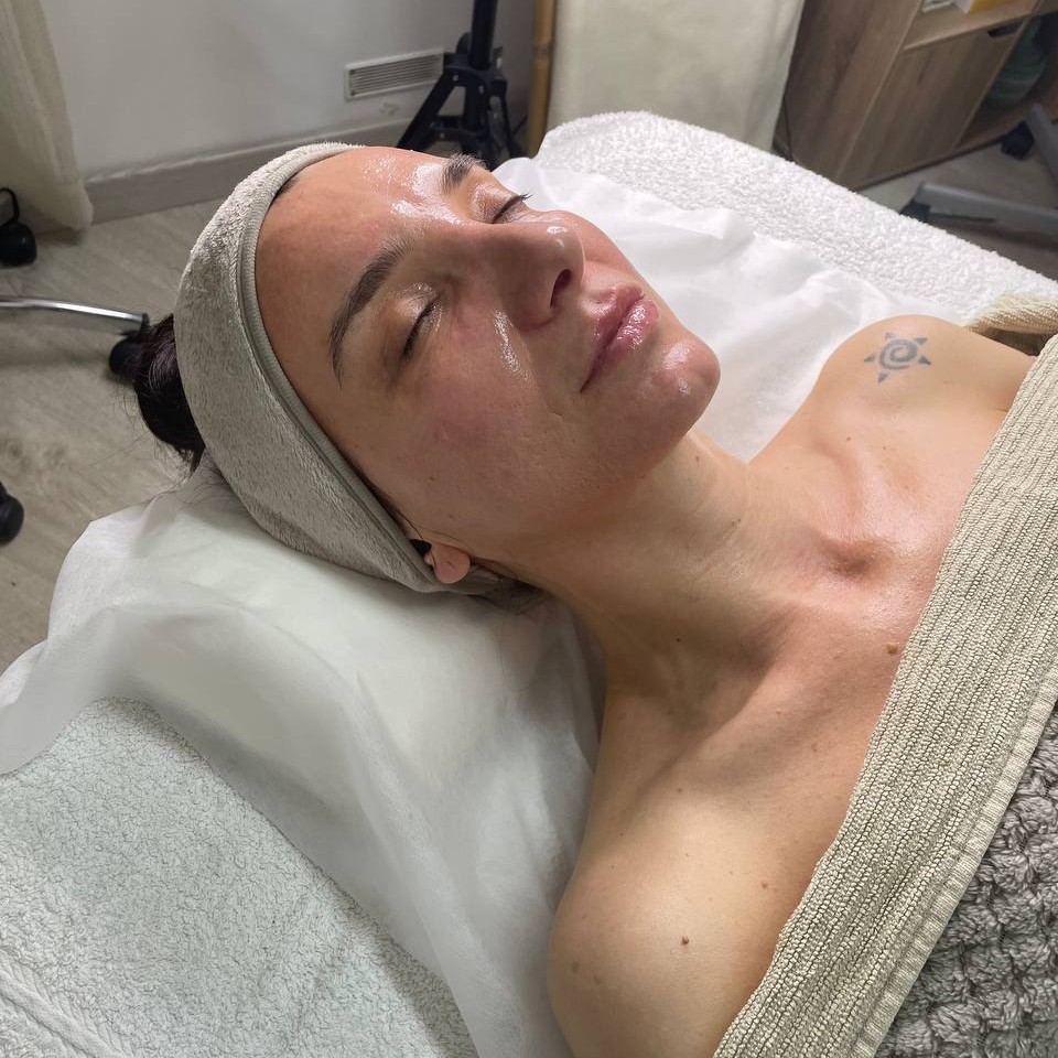 Peeling de diamante (dermoabrasão) / Алмазный пилинг (дермоабразия)/ Diamond peeling (dermabrasion)