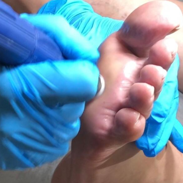 Смарт педикюр (без покрытия)