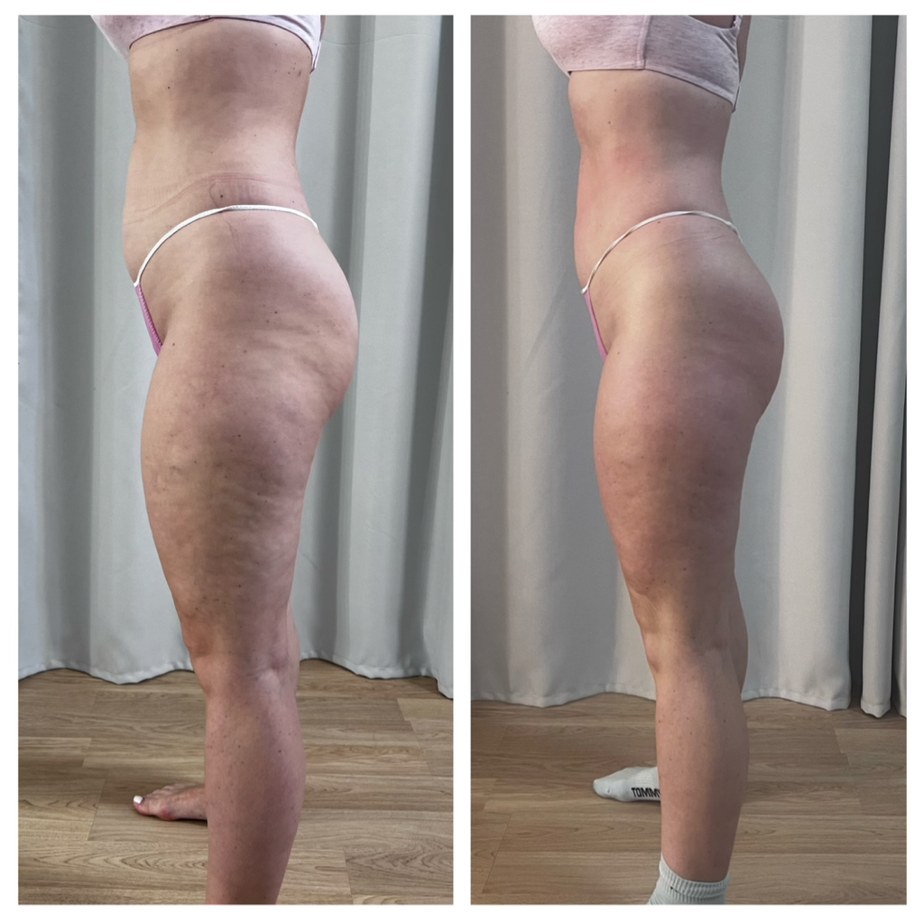 «Двойной комплекс»  

1. Вакуум + вибро  
2. Ик одеяло+ вакуум/вибро   
3. Вакуум/вибро + пресс   
4. Вакуум/вибро + мио    
5. Вакуум/вибро + паук