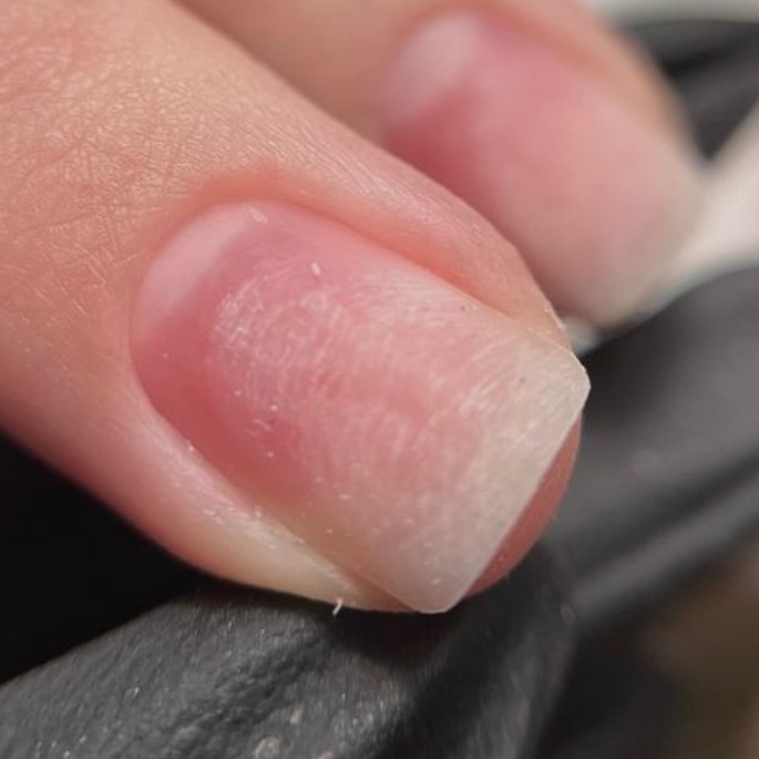 Ремонт ногтя