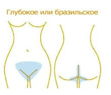 Глубокое бикини Воск