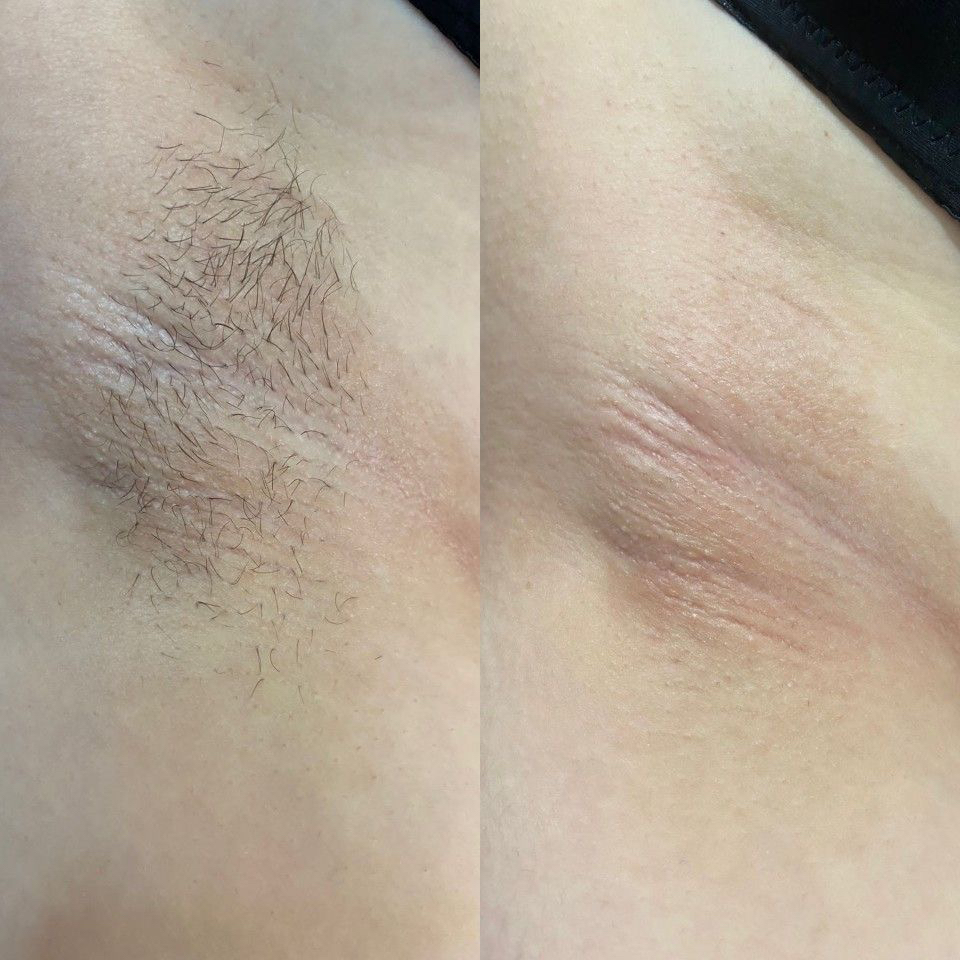 Подмышки  воск