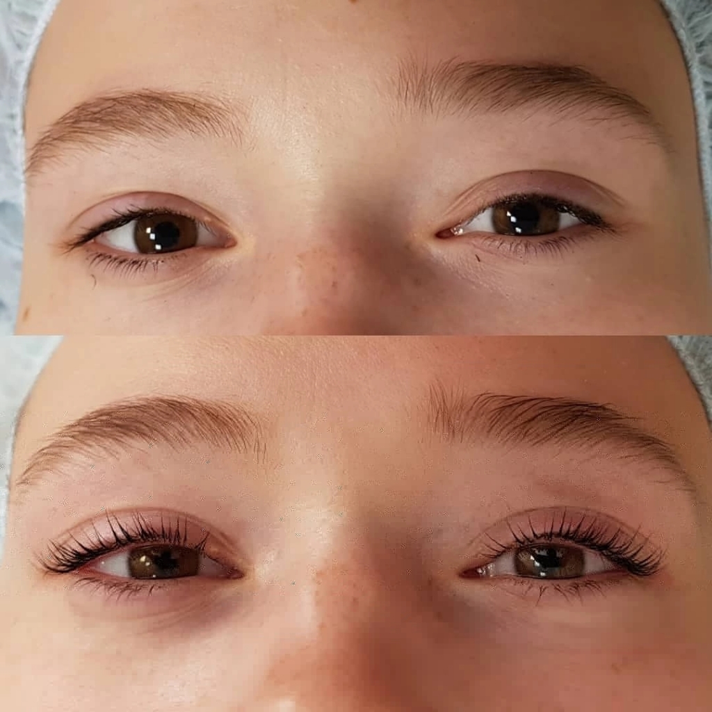 Нанопластика ресниц