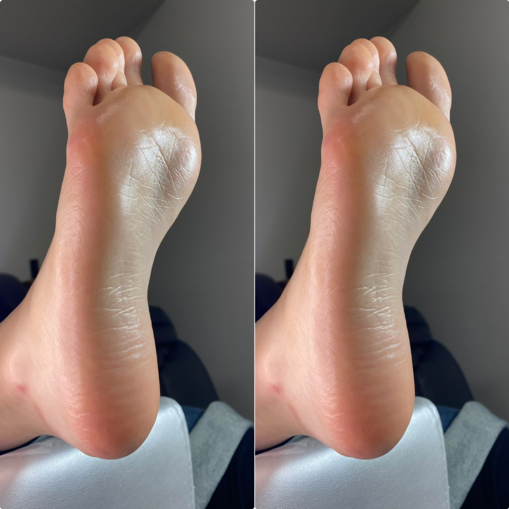 Гигиеническая обработка всей стопы и пальцев