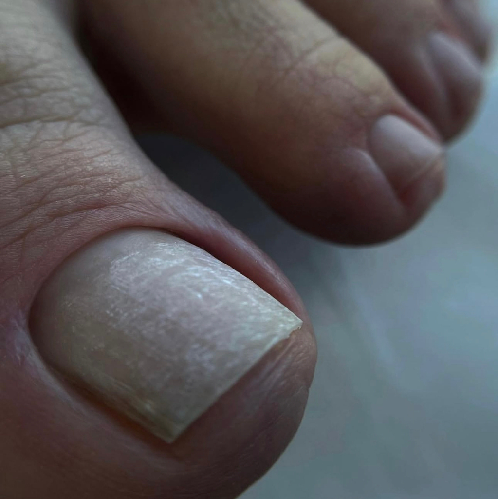 Обработка пальчиков