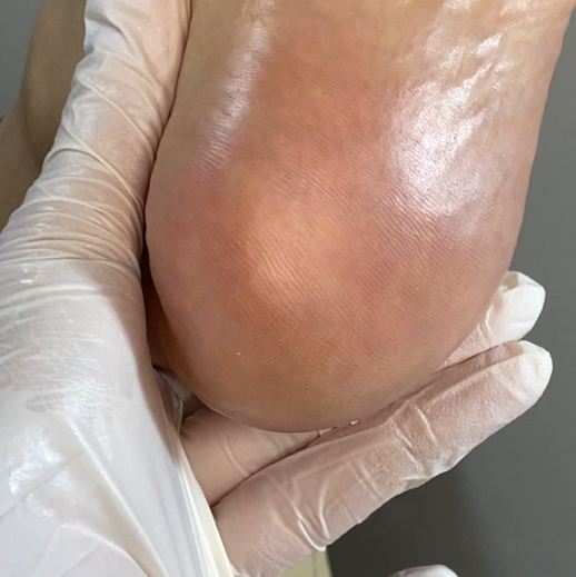 Обработка стоп smart (hard) Инструктор