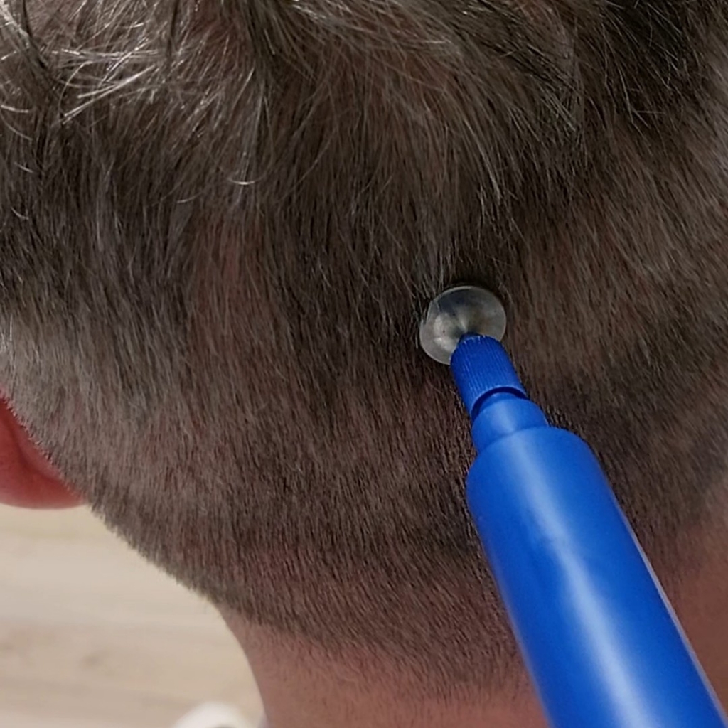 ХП Пилинг головы