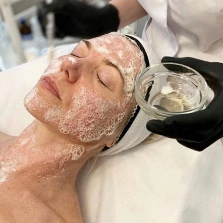 Карбокситерапия неинвазивная (3D collagen)