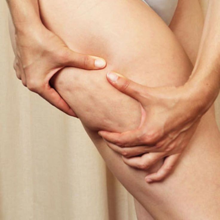 Мезококтейль против целлюлита