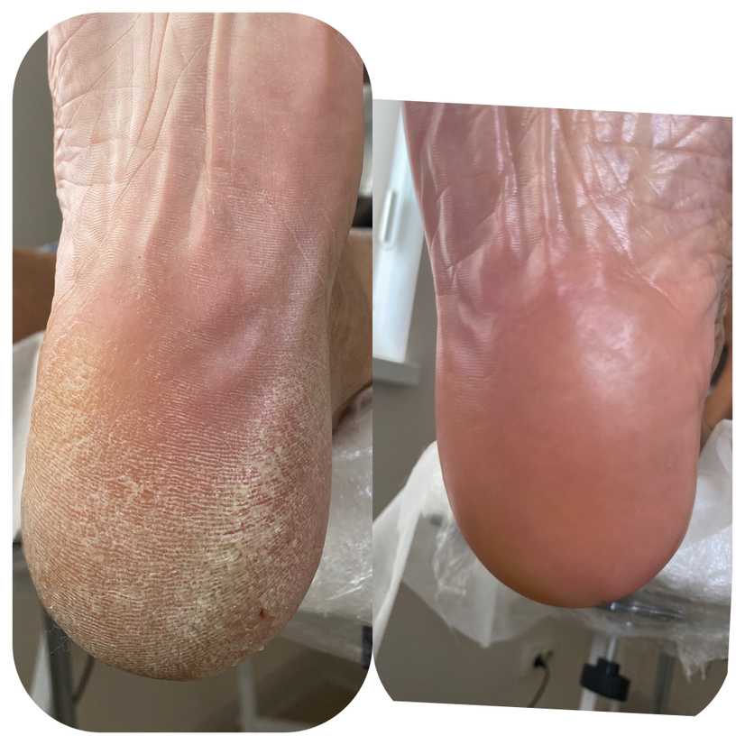 Педикюр Классический Без покрытия