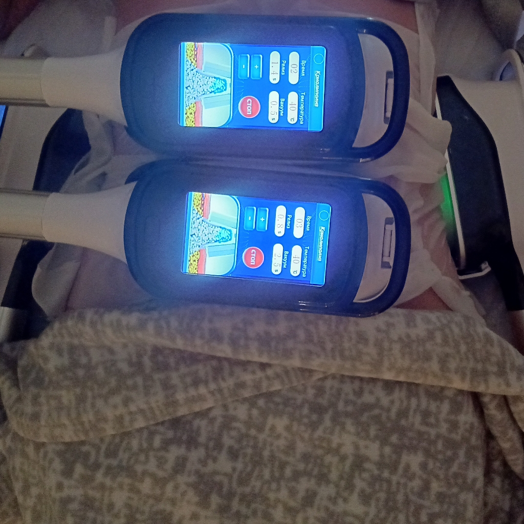 Комплекс Трио ручной (криолиполиз 4 зоны+RF-лифтинг+ручной микс массаж)