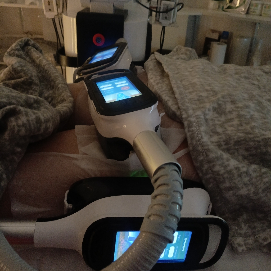 Комплекс Экспресс похудение ручной 60 (криолиполиз 8 зон + RF-лифтинг+кавитация+ручной микс массаж 60 минут)