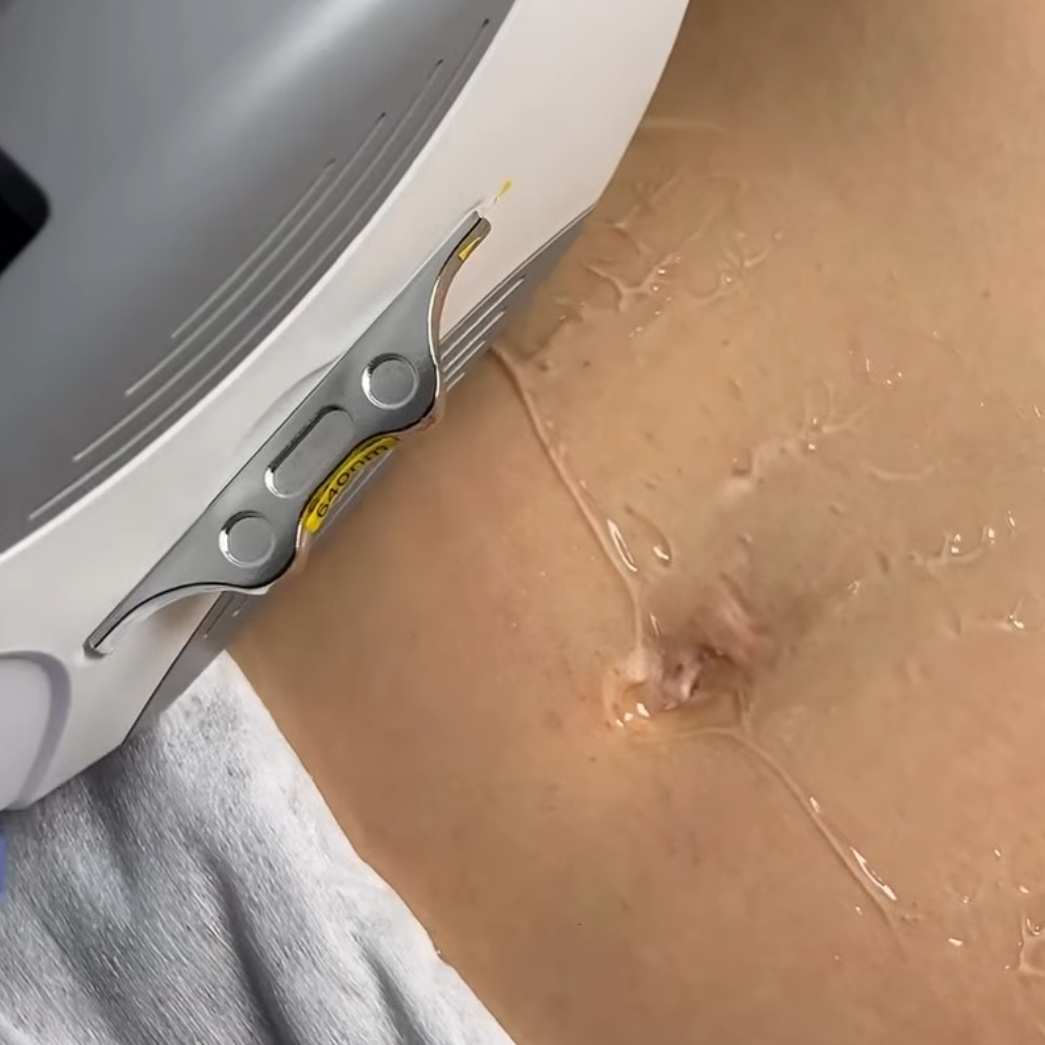 Живот дорожка