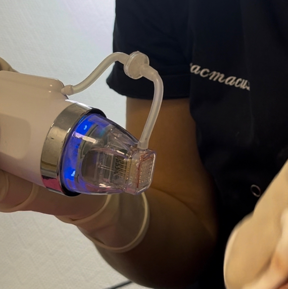 Микроигольчатый RF-лифтинг