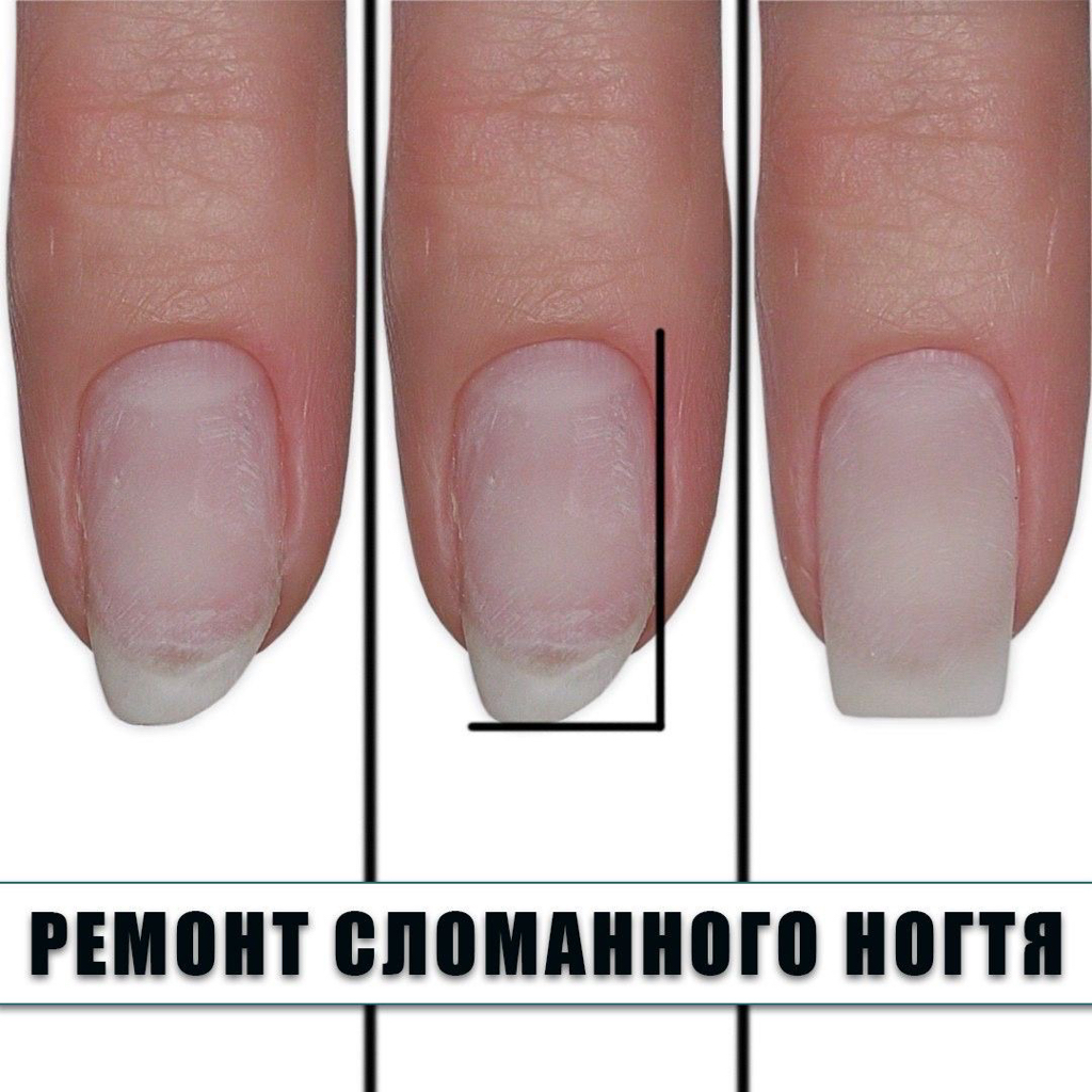 Ремонт ногтя