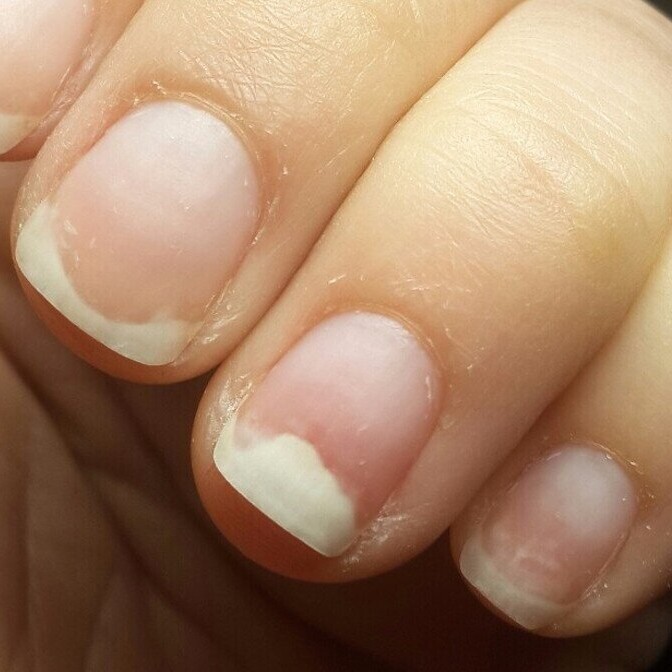 Обработка 1-го ногтя на руках